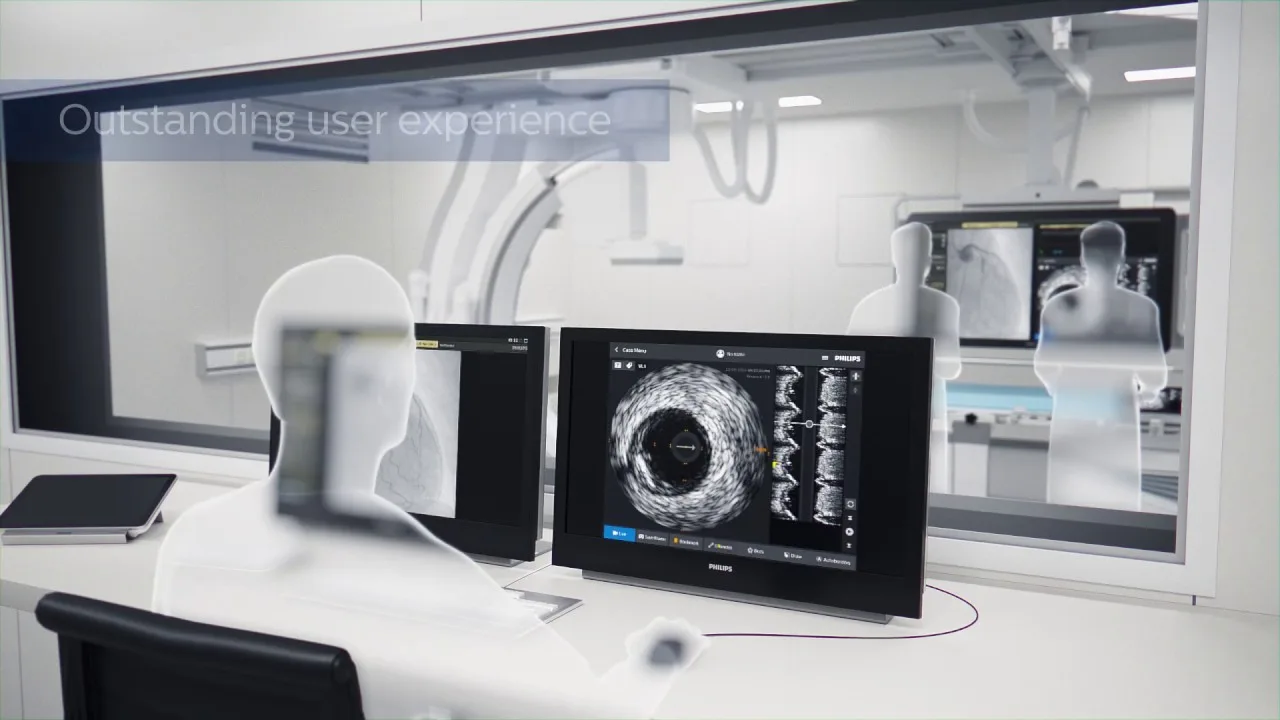Philips SyncVision - Новая эра высокоточной терапии 