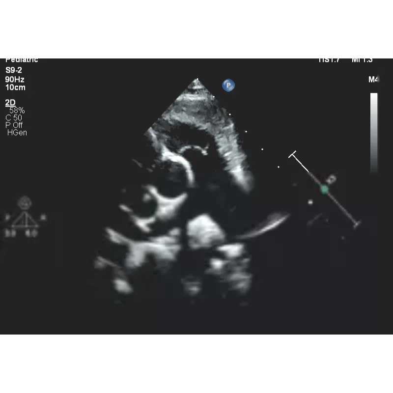 Philips EPIQ CVx ультразвуковой аппарат Philips EPIQ CVx ультразвуковой аппарат