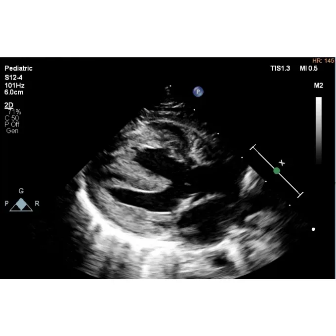 Philips EPIQ CVx ультразвуковой аппарат