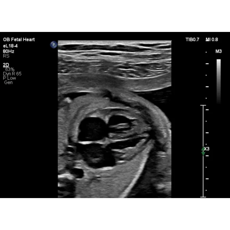 Philips EPIQ CVx ультразвуковой аппарат Philips EPIQ CVx ультразвуковой аппарат