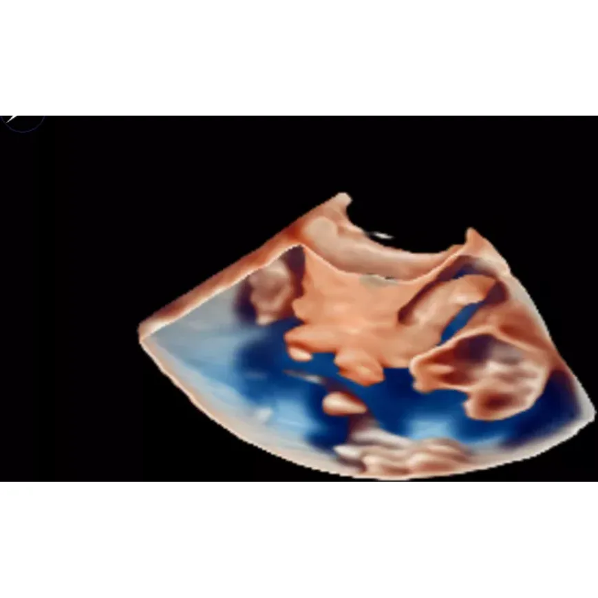 Philips EPIQ CVx ультразвуковой аппарат