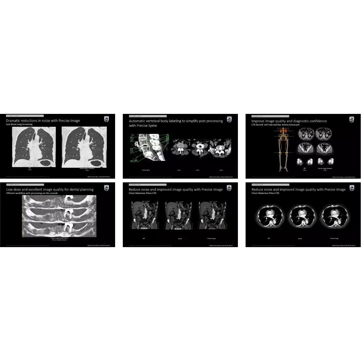 Компьютерный томограф Philips CT 3500 Компьютерный томограф Philips CT 3500