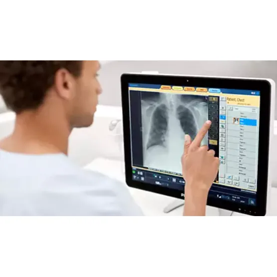 Цифровая рентгенографическая система Philips DuraDiagnost F30 Цифровая рентгенографическая система Philips DuraDiagnost F30