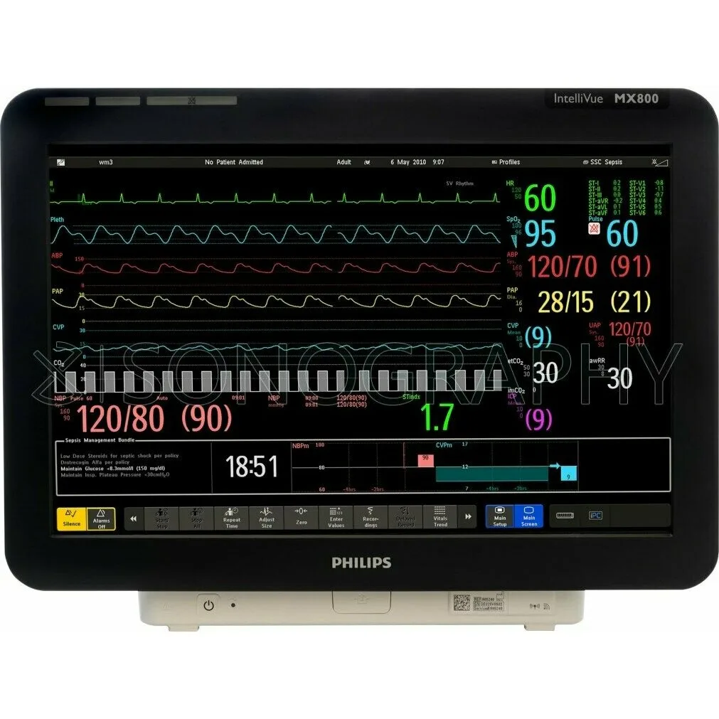 Philips IntelliVue MX800 прикроватный монитор пациента Philips IntelliVue MX800 прикроватный монитор пациента