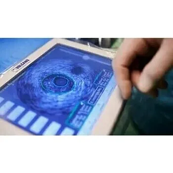 Philips Core Mobile Система для выполнения высокоточной терапии Philips Core Mobile Система для выполнения высокоточной терапии