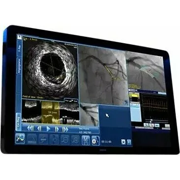 Philips SyncVision Cистема для выполнения высокоточной терапии