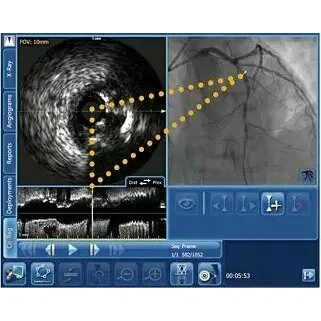 Philips SyncVision Cистема для выполнения высокоточной терапии Philips SyncVision Cистема для выполнения высокоточной терапии
