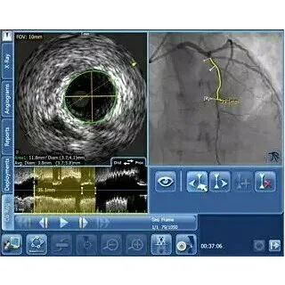 Philips SyncVision Cистема для выполнения высокоточной терапии Philips SyncVision Cистема для выполнения высокоточной терапии