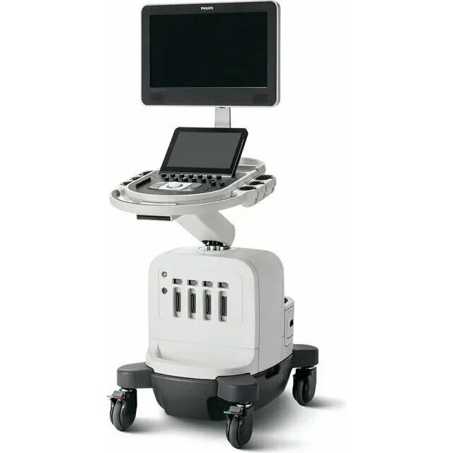 Philips Affiniti 30 ультразвуковой аппарат Philips Affiniti 30 ультразвуковой аппарат