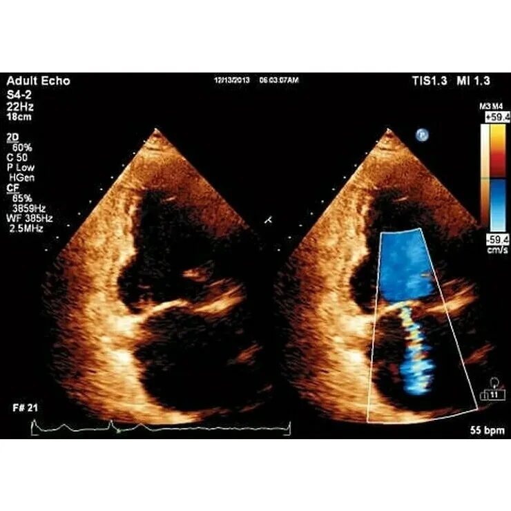 Philips Affiniti 30 ультразвуковой аппарат Philips Affiniti 30 ультразвуковой аппарат