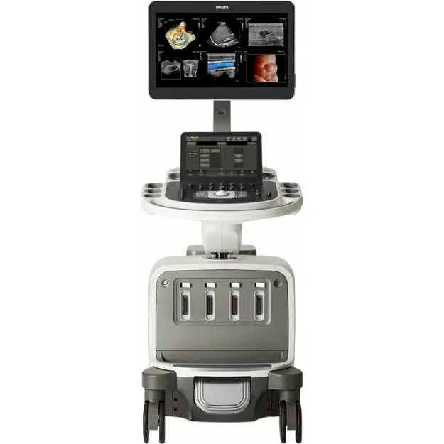 Philips EPIQ Elite ультразвуковой аппарат